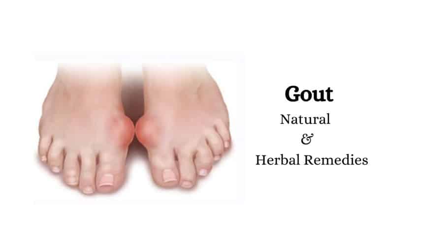 gout cure natural and herbal remedies