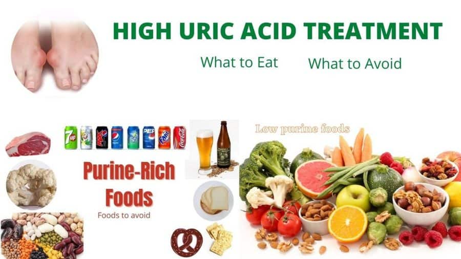 How to Treat Uric Acid Naturally : Diet and Recipes -NaturalCure