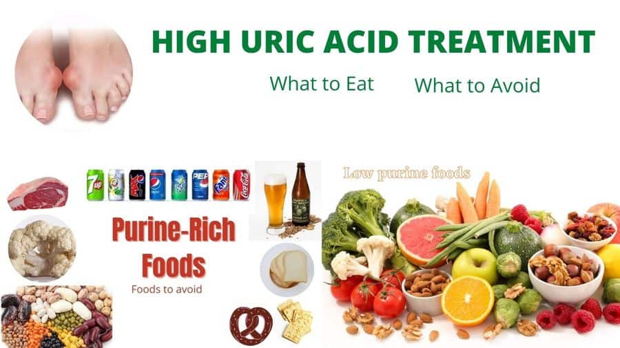 high uric acid treatment